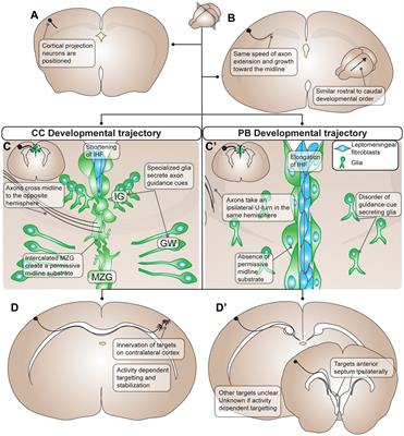 Brain plasticity following corpus callosum agenesis or loss: a review of the Probst bundles